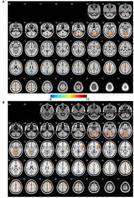 Using Large-Scale Statistical Chinese Brain Template (Chinese2020) in Popular Neuroimage Analysis Toolkits